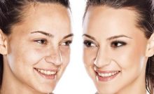 Top 20: Must See Tips To Improve Your Skin & Reduce Wrinkles (2025)