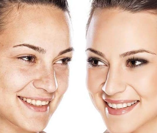 Top 20: Must See Tips To Improve Your Skin & Reduce Wrinkles (2020)