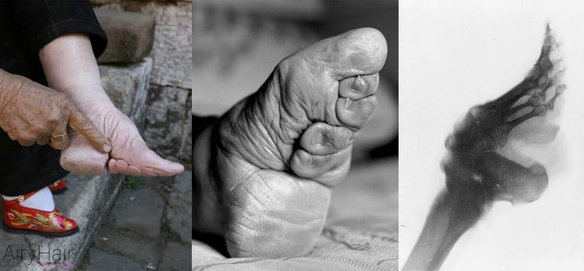 Foot Binding