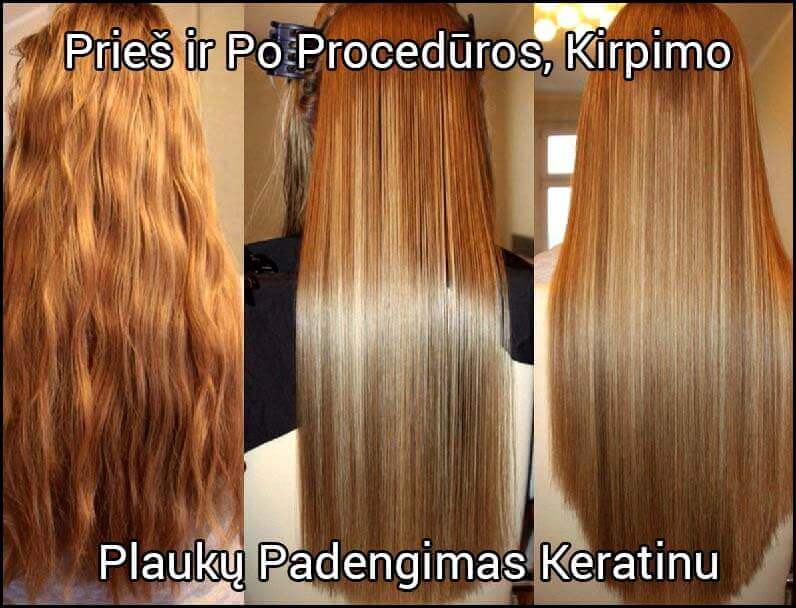 Ilgalaikio Plaukų Tiesinimo Rezultatai. Prieš ir Po