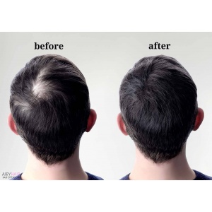 Men Toupees (Mono Wigs) for Balding Spots