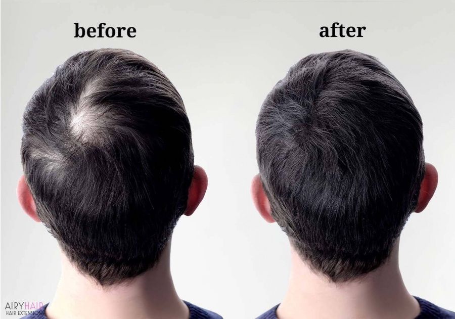 Men Toupees (Mono Wigs) for Balding Spots, Before & After